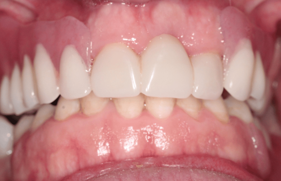 After -Ashbourne Road Dental