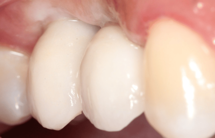 After -Ashbourne Road Dental