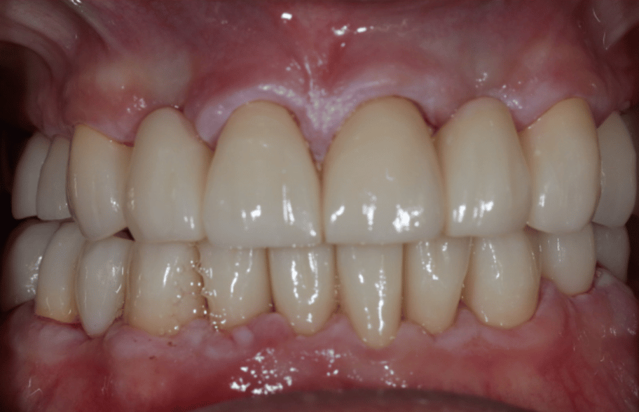 After - Ashbourneroad Dental