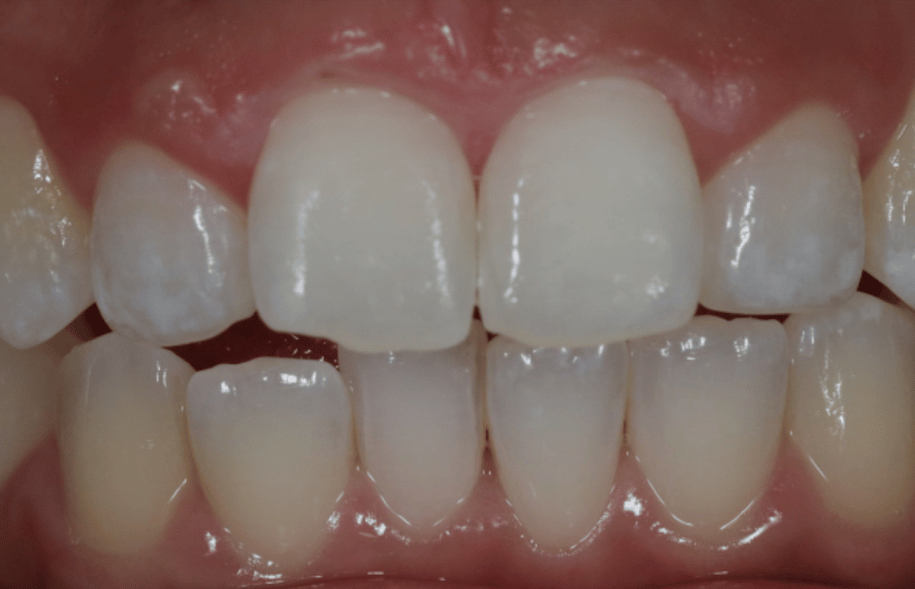 After -Ashbourne Road Dental