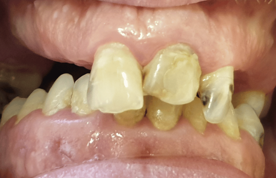 Before - Ashbourneroad Dental