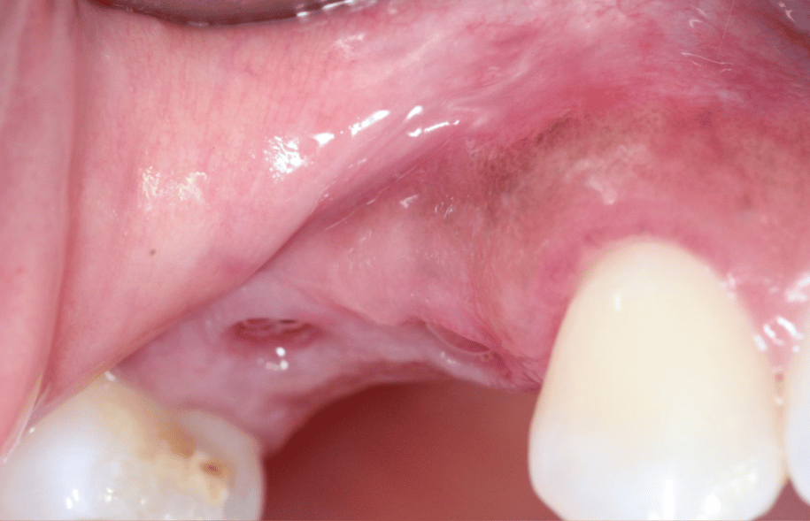 Before - Ashbourne Road Dental