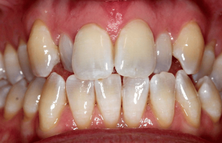Before - Ashbourneroad Dental
