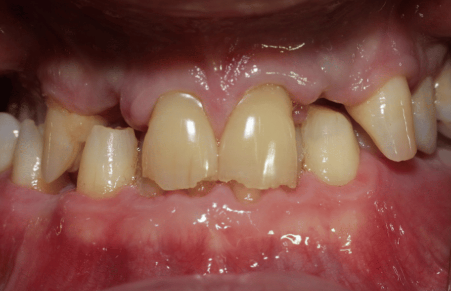 Before - Ashbourneroad Dental