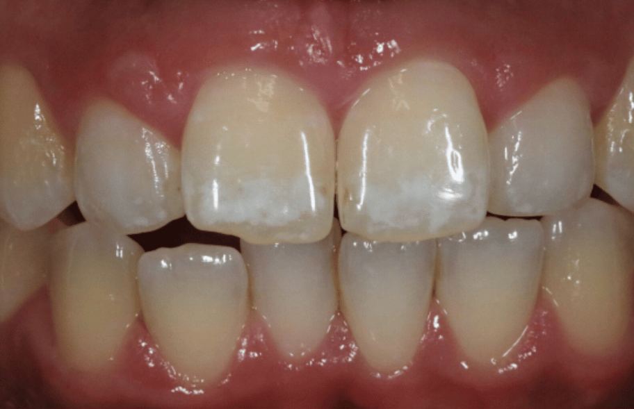 Before - Ashbourneroad Dental