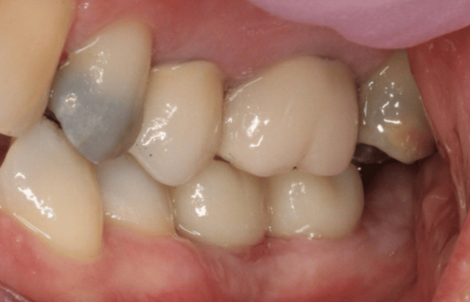 After -Ashbourne Road Dental