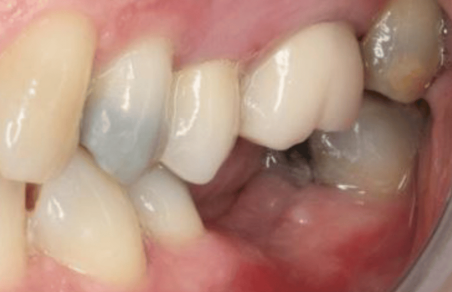 Before - Ashbourneroad Dental