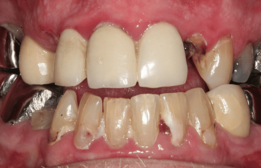 Before - Ashbourneroad Dental
