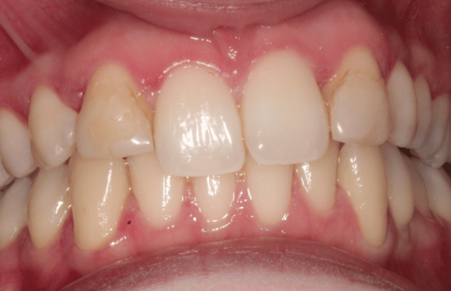 Before - Ashbourneroad Dental