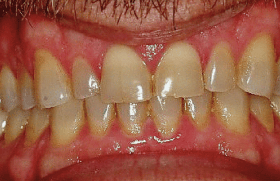 Before - Ashbourneroad Dental